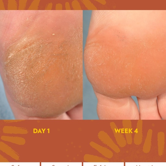 2 Packs- Epoch Sole Solution Foot treatment - Picture 4 of 4